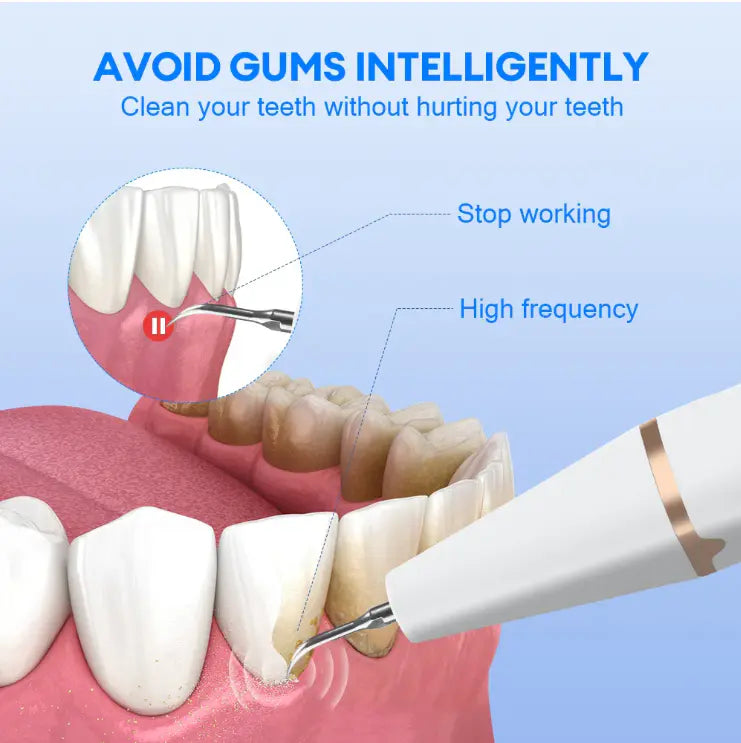 Electric Teeth Cleaner & Stain Remover