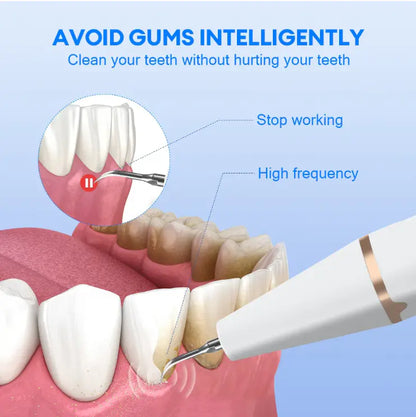 Electric Teeth Cleaner & Stain Remover