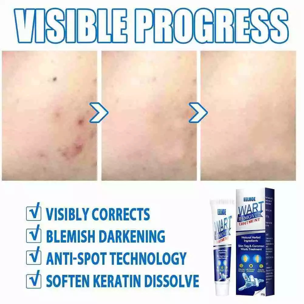 WartAway Herbal Removal Cream