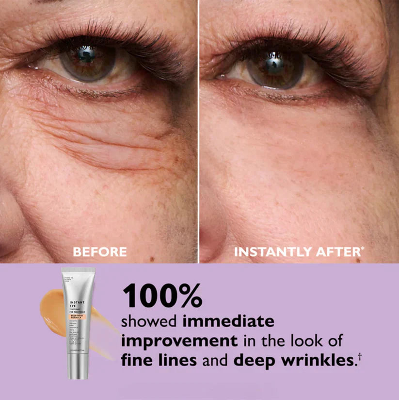 Instant Eye Tightener